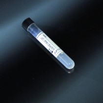 prueba de los tubos con Citrato de Sodio 0.4 ml, 13x75 mm tapón negro para VES Citrato de Na, 1.6 ml de sangre